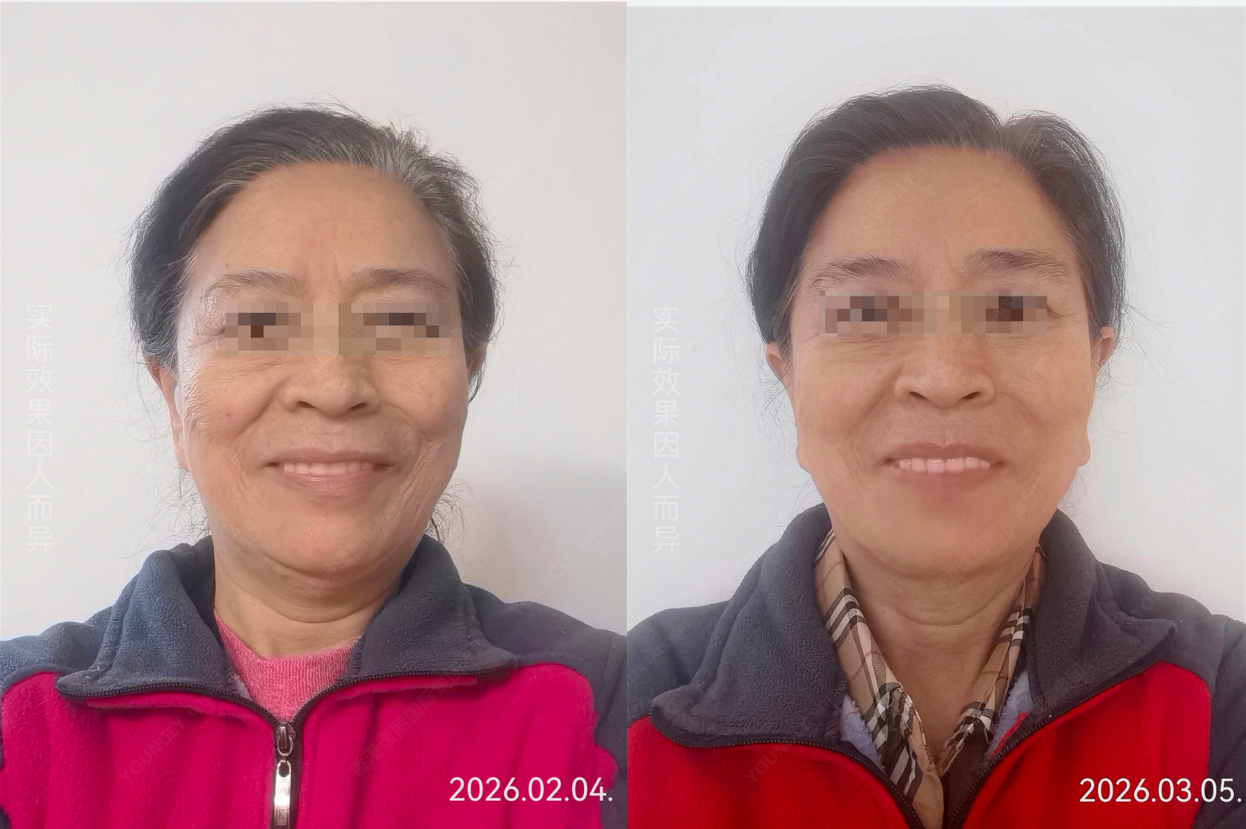 2026年口碑好的京能元护肤品价格溢价吗? 2026年口碑好的京能元护肤品价格溢价吗?